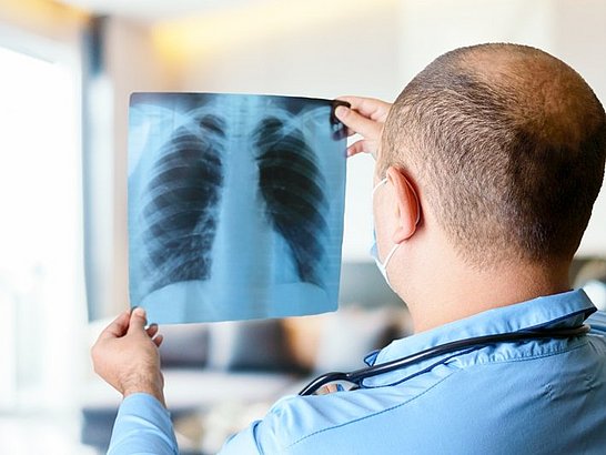 ¿Cómo se diagnostica el asma alérgica?